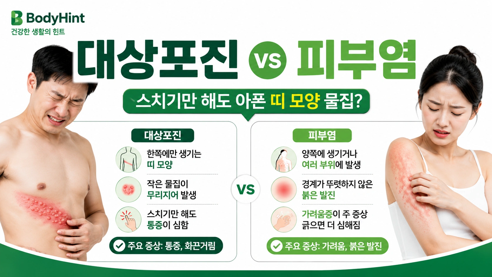 한쪽 몸에 띠 모양 물집과 심한 통증이 나타나는 대상포진과 여러 부위에 붉은 발진과 가려움이 생기는 피부염의 차이를 비교한 대표이미지