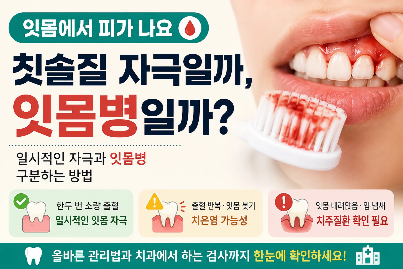 양치할 때 피가 묻은 칫솔과 붉고 부은 잇몸을 보여주며 일시적인 칫솔질 자극인지 잇몸병인지 구분하는 대표이미지