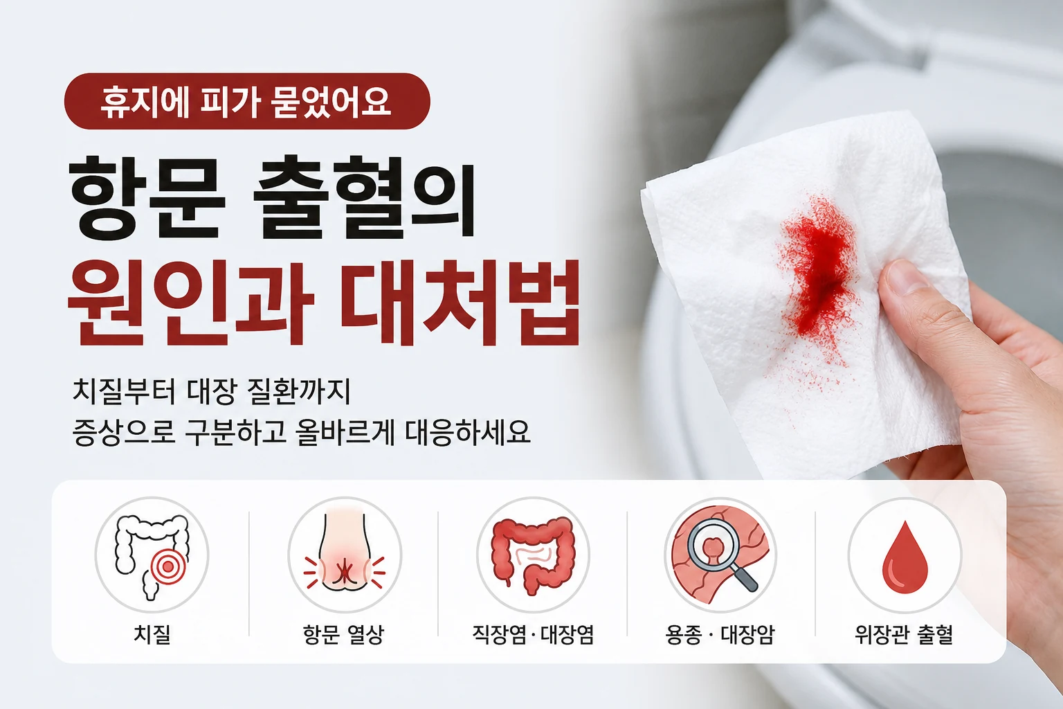 휴지에 선홍색 피가 묻은 모습과 항문 출혈의 원인 및 대처법을 보여주는 이미지