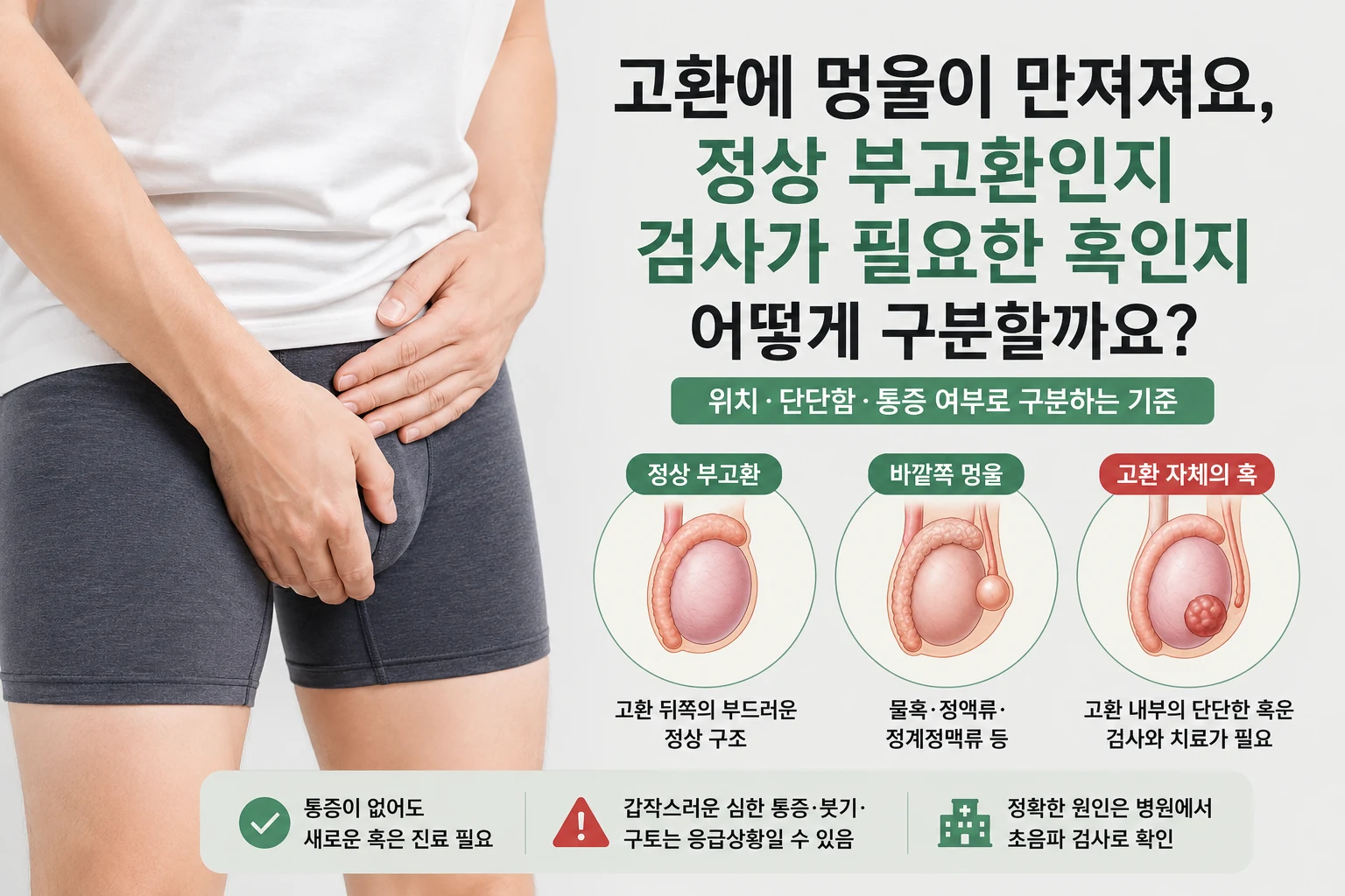 고환 뒤쪽의 정상 부고환, 고환 바깥의 물혹과 혈관, 고환 자체의 단단한 혹을 비교해 보여주는 대표이미지