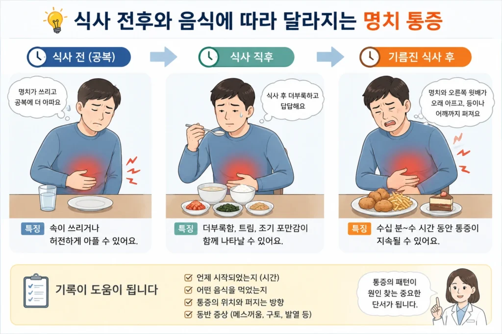 공복, 식사 직후, 기름진 식사 후에 나타나는 명치 통증의 변화와 더부룩함·오른쪽 윗배 및 등으로 퍼지는 통증을 비교한 이미지