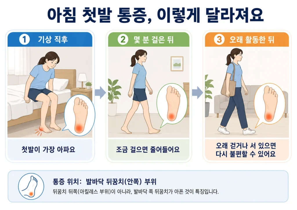 아침 기상 직후 첫발에서 발뒤꿈치 아래 통증이 가장 심하고, 몇 분 걸은 뒤 줄었다가 오래 걷거나 서 있으면 다시 불편해질 수 있는 변화를 단계별로 보여주는 이미지