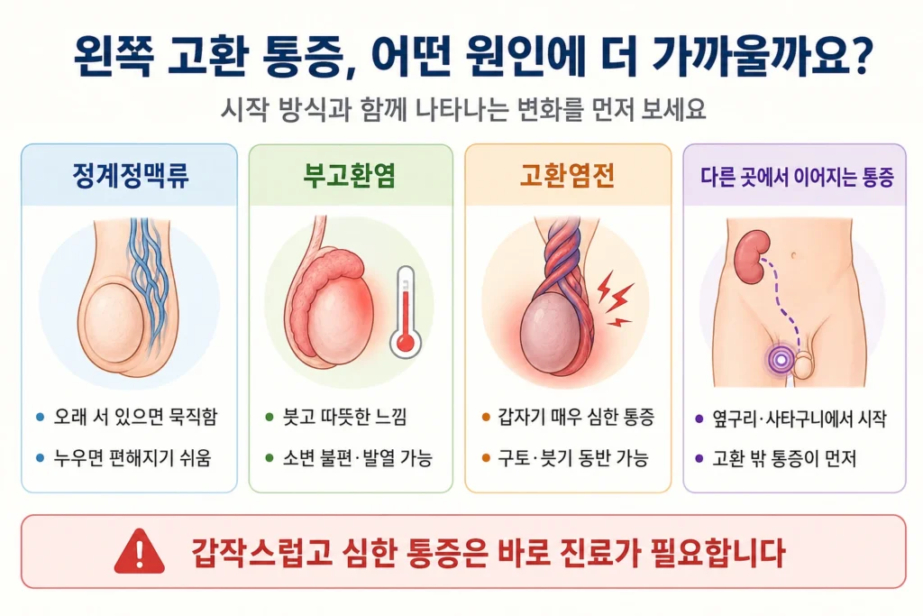 정계정맥류, 부고환염, 고환염전과 옆구리·사타구니에서 이어지는 왼쪽 고환 통증의 특징을 비교한 이미지