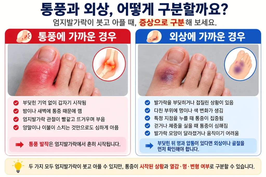 외상 없이 밤사이 엄지발가락 관절 전체가 빨갛고 뜨겁게 부은 통풍 의심 모습과, 발가락을 부딪히거나 접질린 뒤 멍과 압통이 생긴 외상·골절 의심 모습을 비교한 이미지