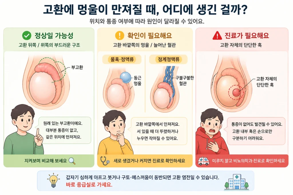 고환 뒤쪽의 정상 부고환, 고환 바깥쪽의 물혹이나 늘어난 혈관, 고환 자체의 단단한 혹을 초록·노랑·빨강 3단계로 비교한 이미지
