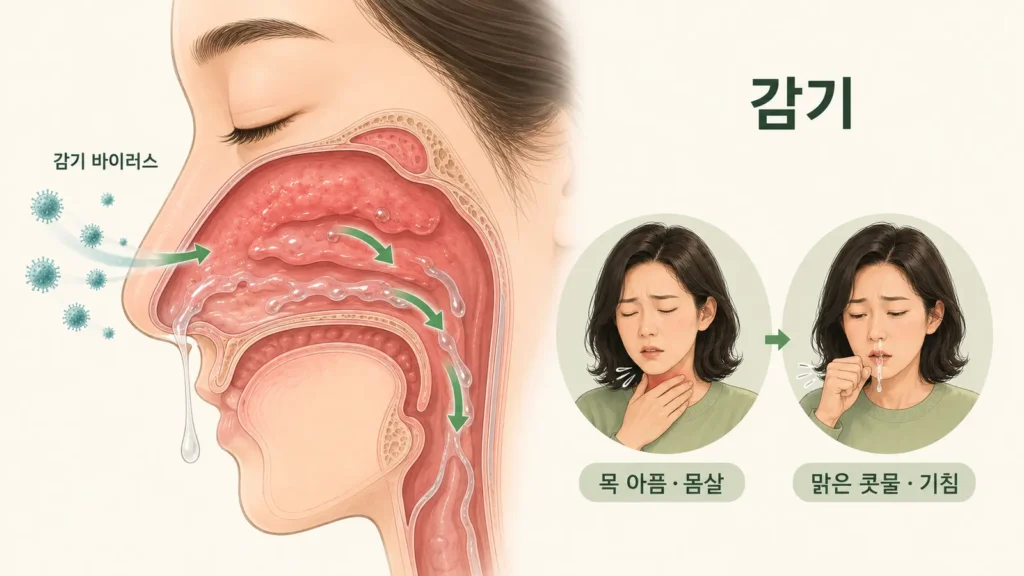 감기 바이러스가 코점막에 염증을 일으켜 맑은 콧물이 생기는 과정