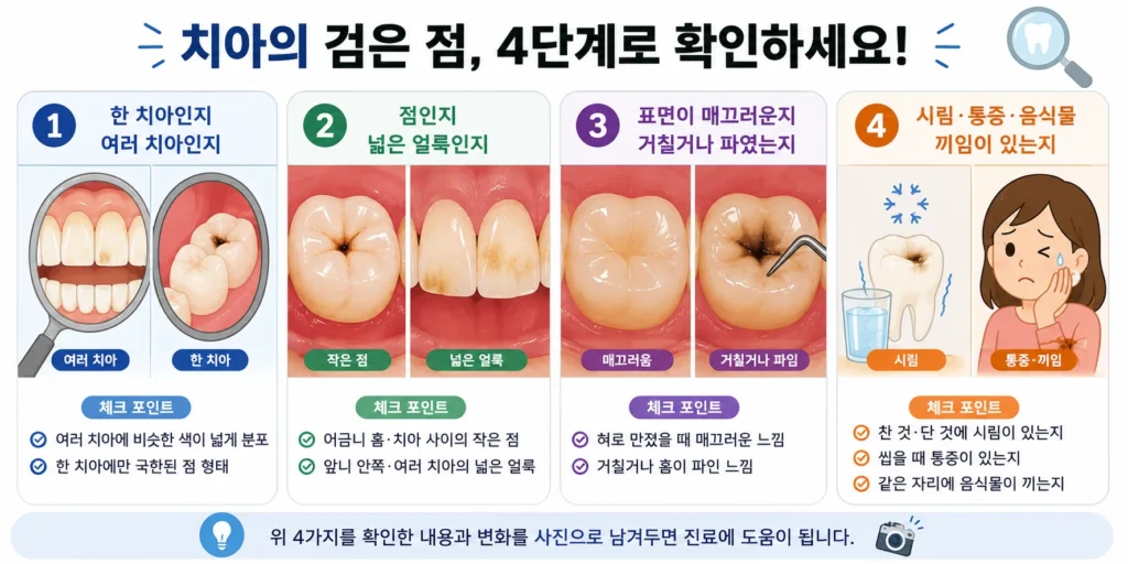 치아의 검은 점이 한 치아인지 여러 치아인지, 작은 점인지 넓은 얼룩인지, 표면이 매끄러운지 거칠거나 파였는지, 시림·통증·음식물 끼임이 있는지를 네 단계로 확인하는 이미지