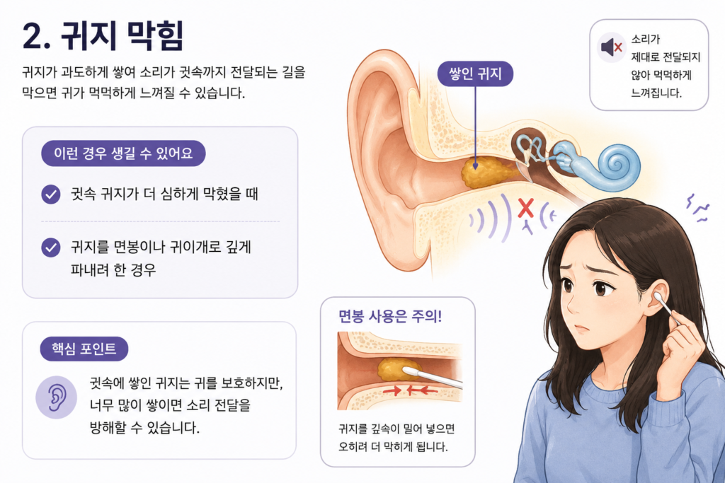 귀지가 쌓여 소리 전달이 막혀 귀가 먹먹해지는 원리를 설명하는 귀 단면 일러스트