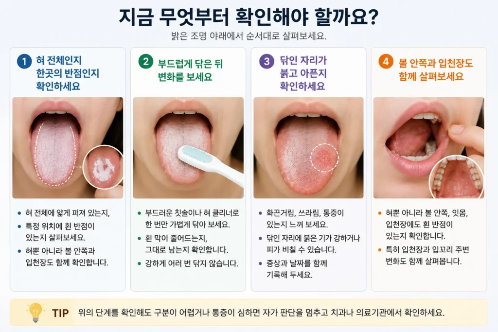 혀 전체인지 한곳의 흰 반점인지 확인하고, 부드럽게 닦은 뒤 변화와 통증, 볼 안쪽과 입천장의 흰 반점을 순서대로 살펴보는 4단계 이미지
