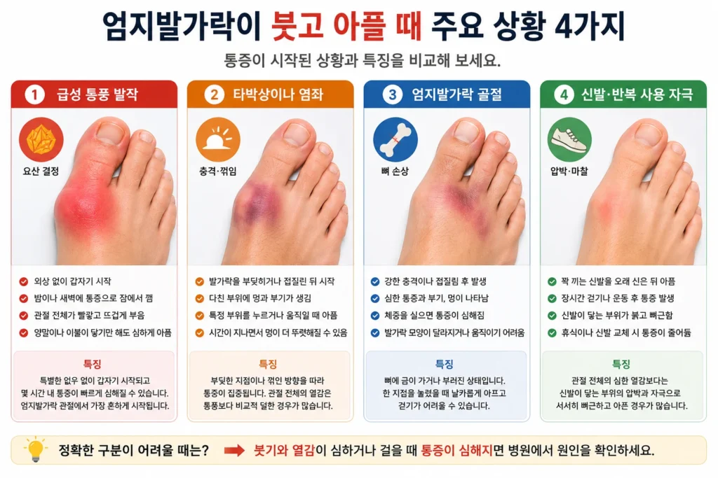 엄지발가락이 붓고 아플 때 급성 통풍 발작, 타박상·염좌, 엄지발가락 골절, 꽉 끼는 신발과 반복 사용 자극의 특징을 네 가지로 비교한 이미지