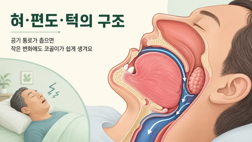 큰 혀와 편도, 뒤로 들어간 턱의 구조로 공기 통로가 좁아져 코골이가 쉽게 생기는 과정을 설명한 그림