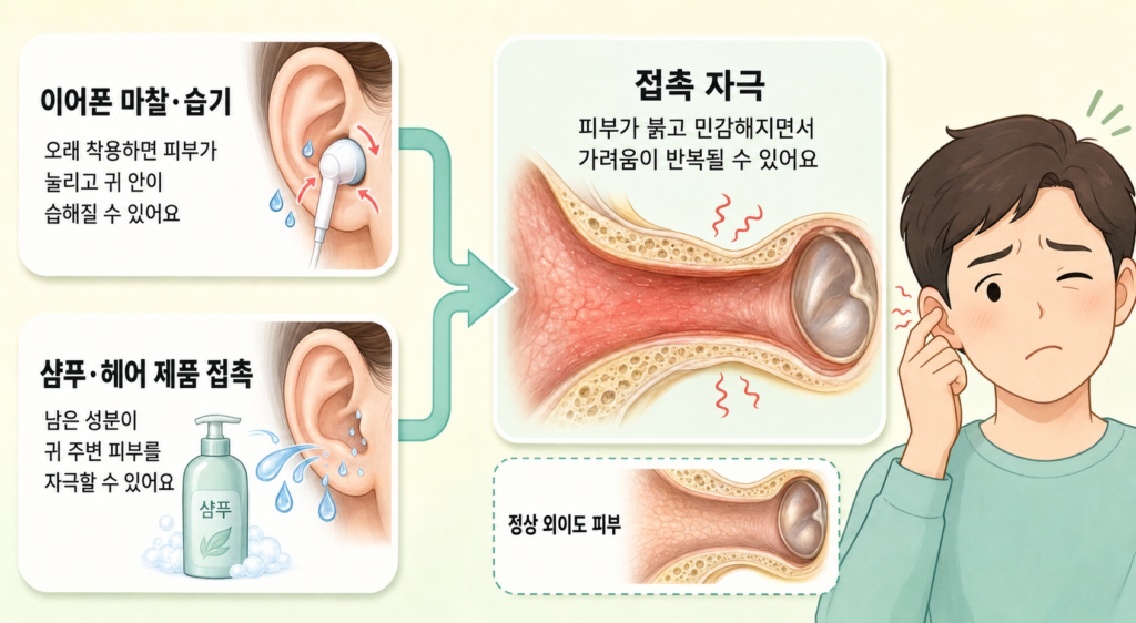 이어폰과 샴푸 등이 귀 주변 피부를 자극하는 과정을 설명한 일러스트