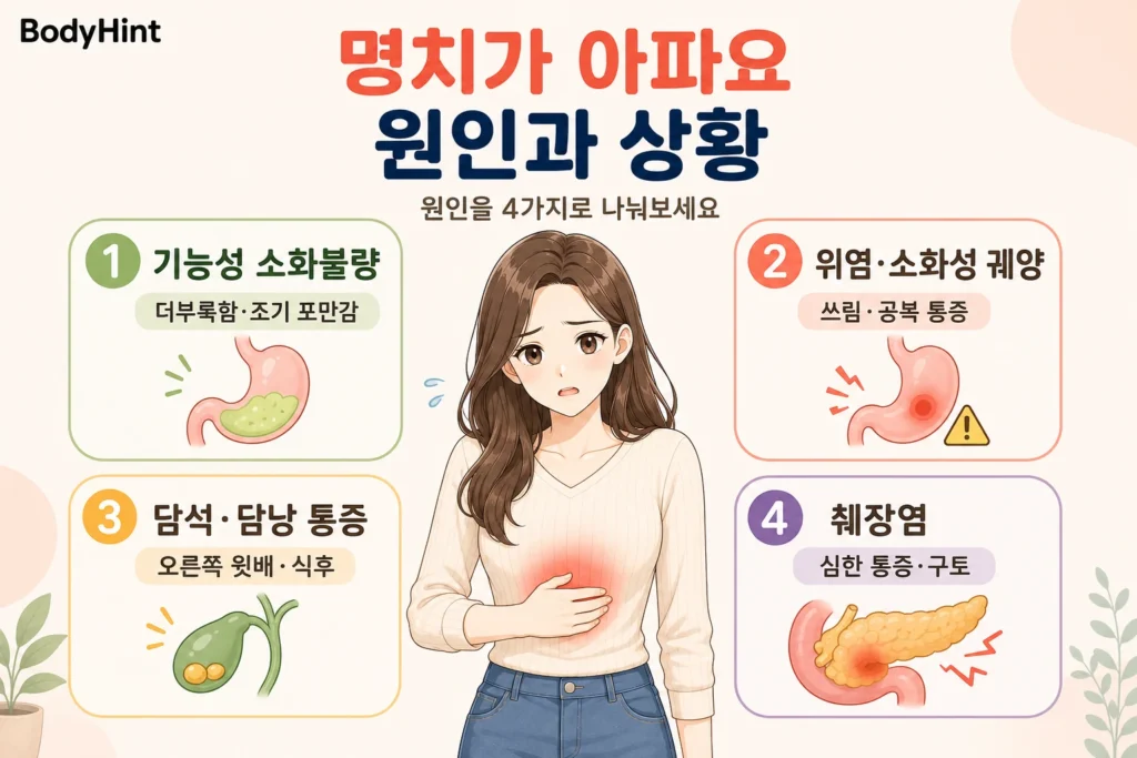 명치 통증의 주요 원인으로 기능성 소화불량, 위염·소화성 궤양, 담석·담낭 통증, 췌장염을 대표 여성 캐릭터와 함께 간단히 보여주는 BodyHint 인포그래픽
