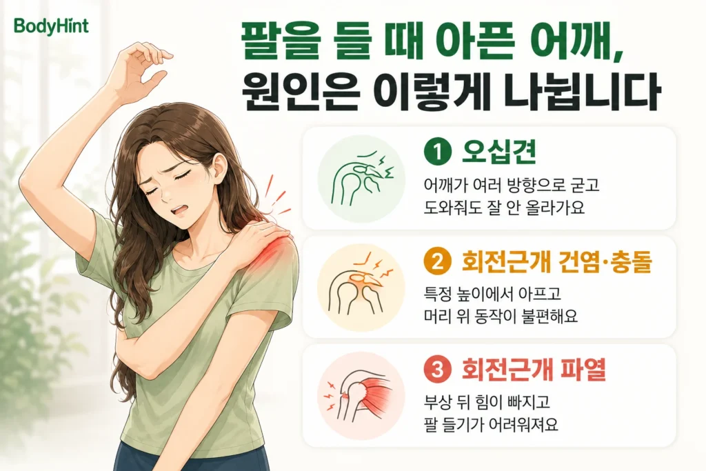 팔을 들 때 어깨 통증의 주요 원인으로 오십견, 회전근개 건염·충돌, 회전근개 파열을 대표 여성 캐릭터와 함께 간단히 보여주는 BodyHint 인포그래픽