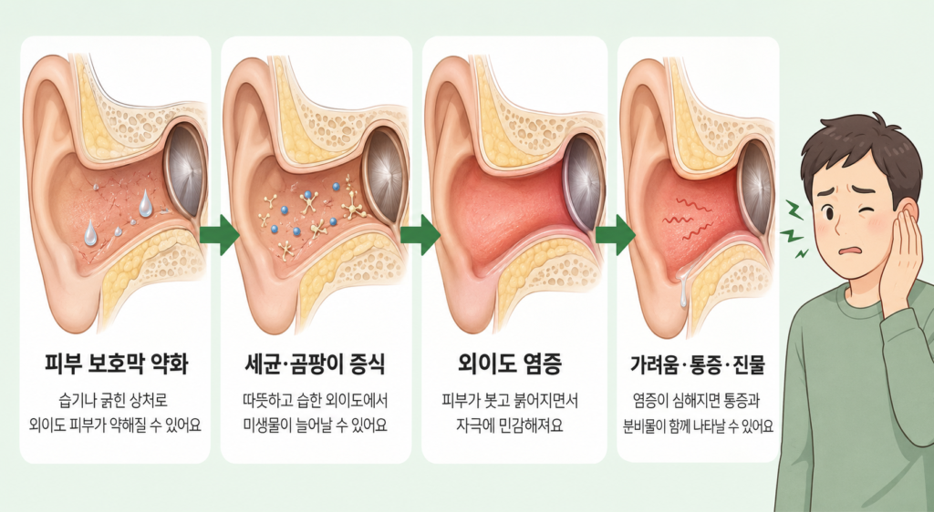 외이도 피부에 염증이 생겨 붓고 진물이 나타나는 과정을 설명한 일러스트