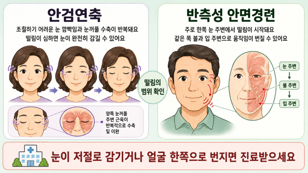안검연축과 반측성 안면경련으로 눈꺼풀이 반복해서 감기거나 떨림이 한쪽 얼굴로 번지는 모습을 설명한 일러스트