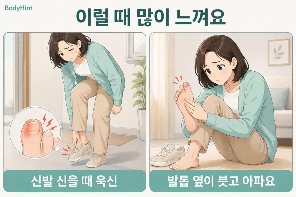 신발을 신을 때 엄지발톱 옆이 욱신거리고 신발을 벗은 뒤 붓고 아픈 발톱 가장자리를 확인하는 여성의 2컷 일러스트
