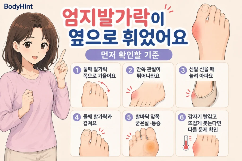 엄지발가락이 둘째 발가락 쪽으로 기울었는지, 안쪽 관절 돌출과 신발 통증, 발가락 겹침, 발바닥 굳은살, 갑작스러운 붓기를 확인하는 기준