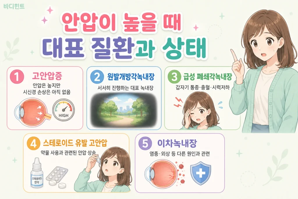 안압이 높을 때 함께 확인하는 고안압증, 원발개방각녹내장, 급성 폐쇄각녹내장, 스테로이드 유발 고안압, 이차녹내장