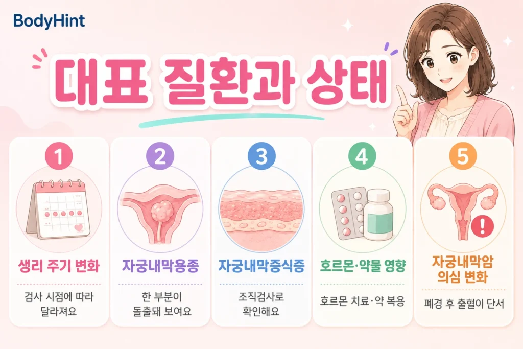 자궁내막 두꺼움과 관련된 생리 주기 변화, 자궁내막용종, 자궁내막증식증, 호르몬·약물 영향, 자궁내막암 의심 변화를 정리한 이미지