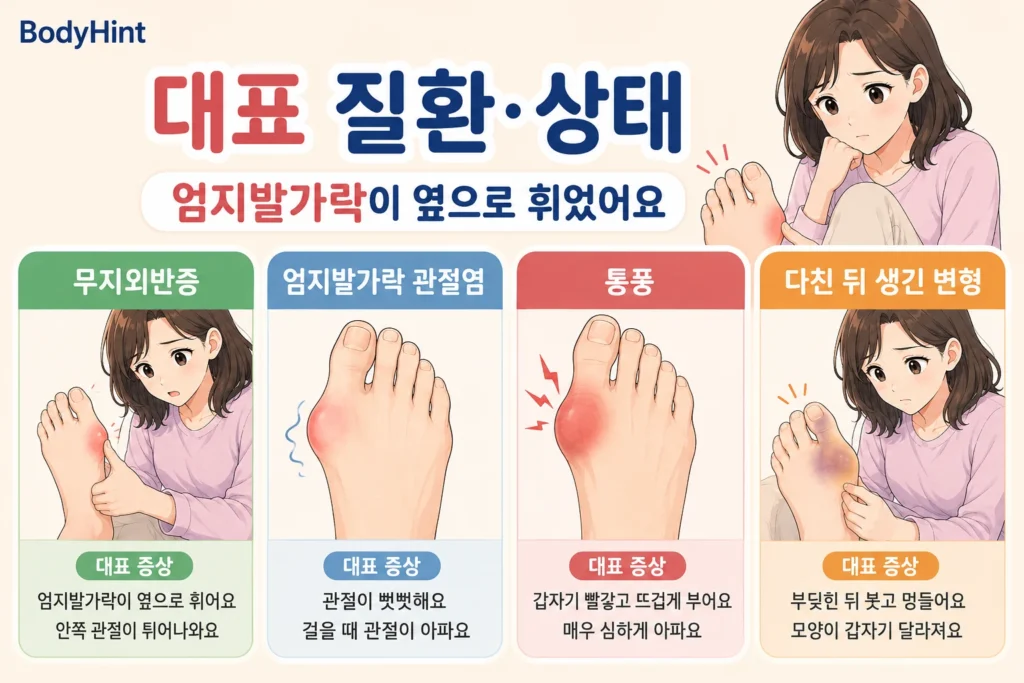 엄지발가락 변형과 통증에서 구분하는 무지외반증, 엄지발가락 관절염, 통풍, 외상 후 변형의 대표 증상을 설명한 이미지
