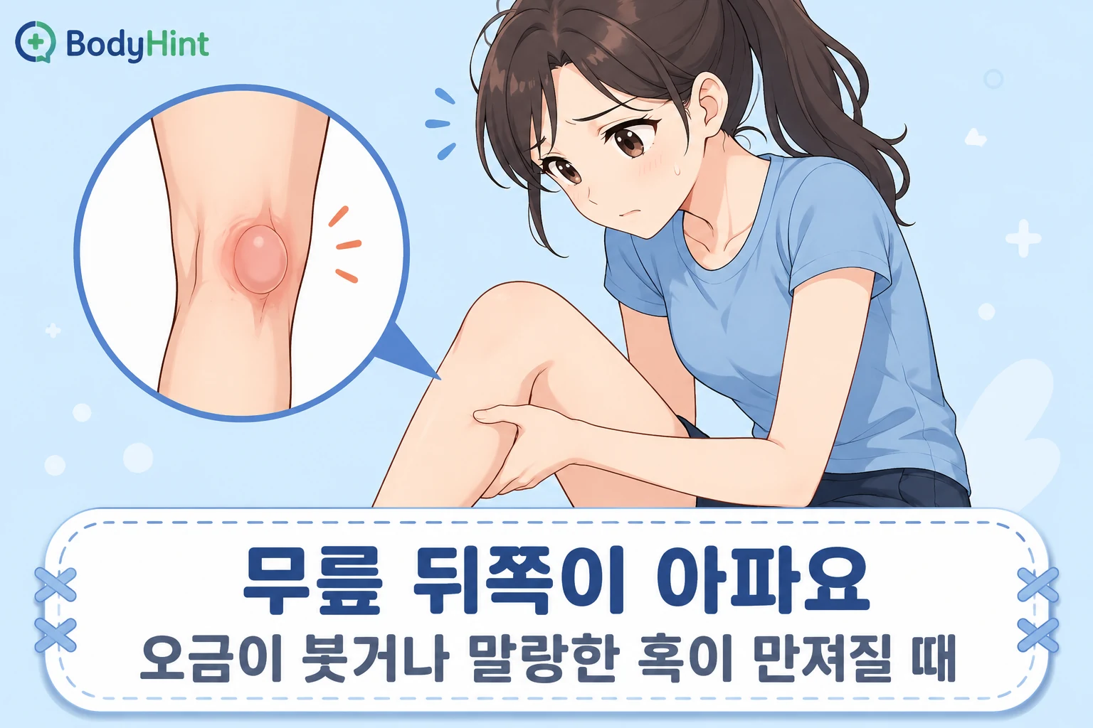긴 갈색 머리의 20대 여성 대표캐릭터가 무릎 뒤쪽을 손으로 짚으며 불편해하고, 옆의 확대 원에 오금 뒤쪽의 붓기와 말랑한 혹이 보이는 안내 이미지