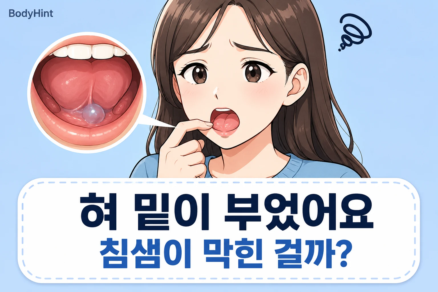 혀 밑에 투명한 물혹이 생긴 모습을 대표캐릭터와 확대 그림으로 보여주는 대표이미지