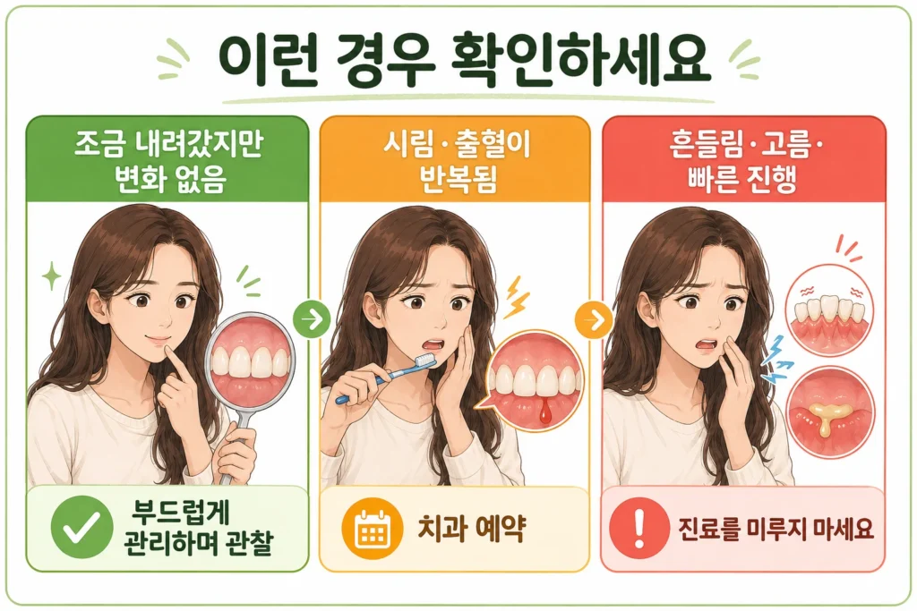 잇몸이 조금 내려갔지만 변화가 없을 때는 부드럽게 관리하며 관찰하고, 시림과 출혈이 반복되면 치과를 예약하며, 흔들림·고름·빠른 진행이 있으면 진료를 미루지 말아야 한다는 3단계 이미지