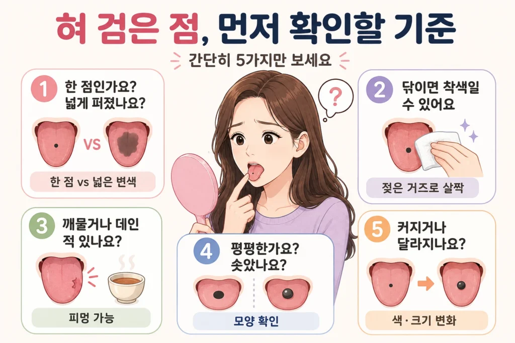 긴 갈색 머리의 여성이 혀의 검은 변화가 한 점인지 넓게 퍼졌는지, 닦이는 착색인지, 깨물거나 데인 적이 있는지, 평평한지 솟았는지, 크기와 색이 변하는지를 확인하는 안내 이미지