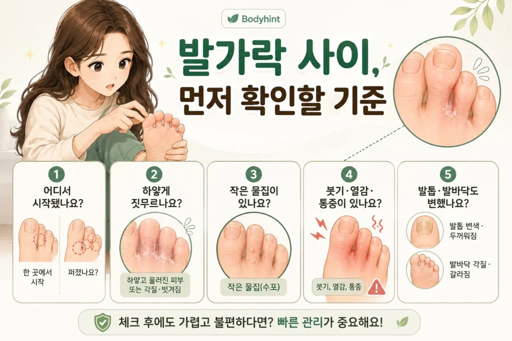 긴 갈색 머리의 여성이 발가락 사이 피부를 확인하며 증상이 어디서 시작됐는지, 하얗게 짓무르는지, 작은 물집이 있는지, 붓기·열감·통증이 동반되는지, 발바닥과 발톱까지 변했는지를 살펴보는 안내 이미지