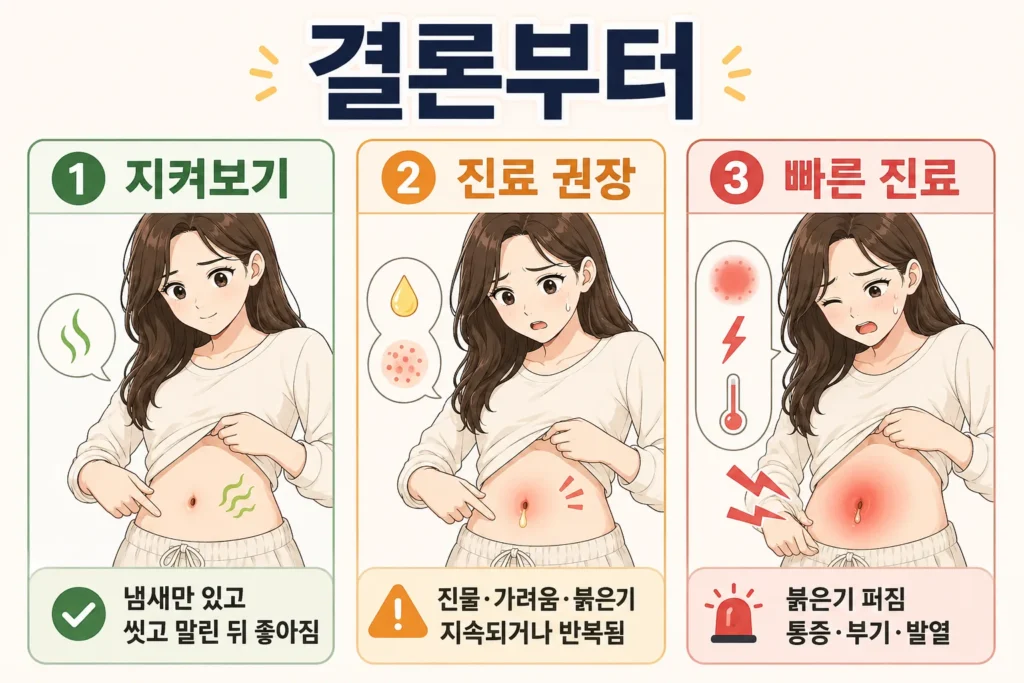 배꼽 냄새만 있고 씻고 말린 뒤 좋아지면 지켜보고, 진물·가려움·붉은기가 지속되거나 반복되면 진료를 받으며, 붉은기가 퍼지고 통증·부기·발열이 있으면 빠르게 진료해야 함을 대표 여성 캐릭터로 보여주는 3단계 이미지