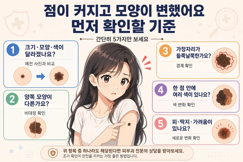 점이 커지고 모양이 변했을 때 크기·모양·색 변화, 양쪽 모양 차이, 불규칙한 가장자리, 여러 색, 피·딱지·가려움을 확인하는 5가지 기준을 일본풍 애니 스타일 여성 대표캐릭터와 함께 보여주는 이미지