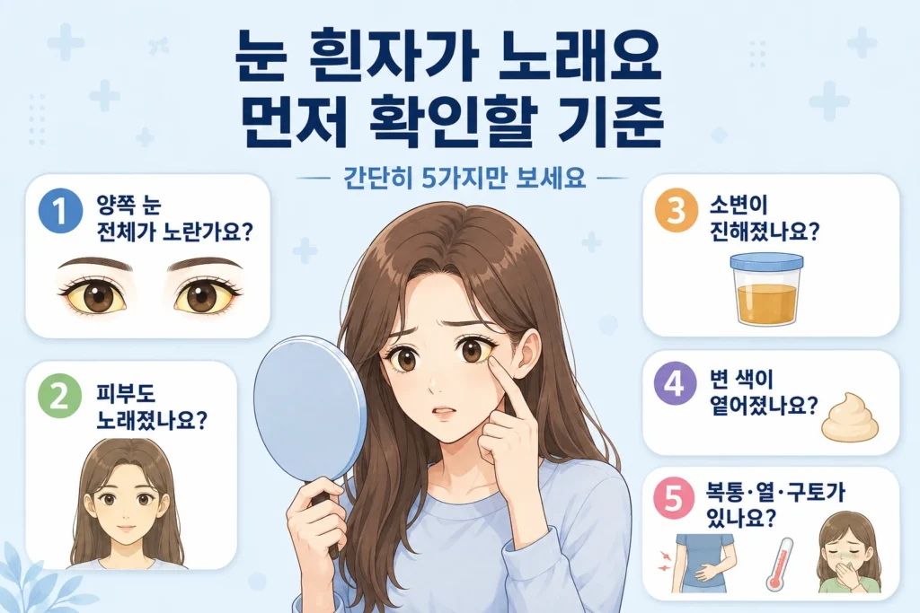 눈 흰자가 노랗게 보일 때 양쪽 눈 전체 변화, 피부색 변화, 진한 소변, 옅은 변, 복통·열·구토 동반 여부를 여성 대표캐릭터와 5개 카드로 보여주는 먼저 확인할 기준 이미지