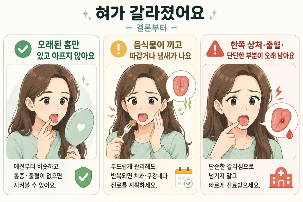 혀가 갈라졌을 때 오래된 홈만 있어 지켜봐도 되는 경우, 음식물이 끼고 따가워 진료를 계획할 경우, 한쪽 상처·출혈·단단한 부분으로 빠른 진료가 필요한 경우를 여성 캐릭터로 설명한 이미지