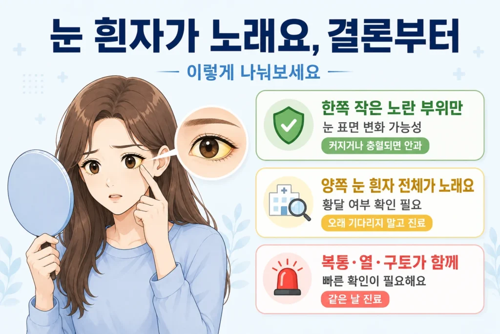 한쪽 눈에 작은 노란 부위만 있는 경우, 양쪽 눈 흰자 전체가 노란 경우, 복통·열·구토가 함께하는 경우를 여성 대표캐릭터와 초록·노랑·빨강 카드로 구분한 결론부터 이미지