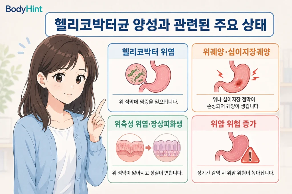 헬리코박터균 양성과 관련된 헬리코박터 위염, 위궤양과 십이지장궤양, 위축성 위염과 장상피화생, 위암 위험 증가를 일본애니풍 여성 캐릭터와 함께 설명한 BodyHint 인포그래픽