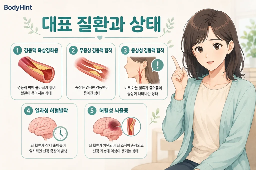 경동맥 플라크와 관련된 경동맥 죽상경화증, 무증상 경동맥 협착, 증상성 경동맥 협착, 일과성 허혈발작, 허혈성 뇌졸중을 정리한 이미지