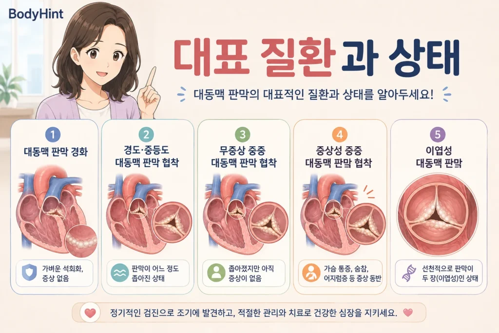 대동맥 판막 경화, 경도·중등도 대동맥 판막 협착, 무증상 중증 협착, 증상성 중증 협착, 이엽성 대동맥 판막을 정리한 이미지