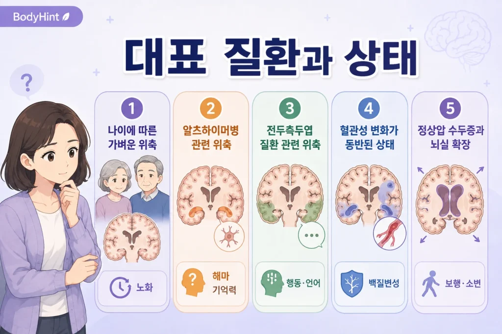 나이에 따른 가벼운 뇌 위축, 알츠하이머병 관련 위축, 전두측두엽 질환 관련 위축, 혈관성 변화가 동반된 상태, 정상압 수두증과 뇌실 확장을 비교한 이미지