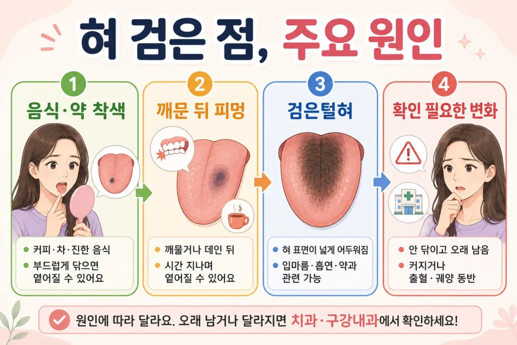 긴 갈색 머리의 여성이 혀의 검은 점을 확인하며 음식·약 착색, 깨문 뒤 피멍, 검은털혀, 오래 남거나 커지는 확인이 필요한 변화를 살펴보는 안내 이미지