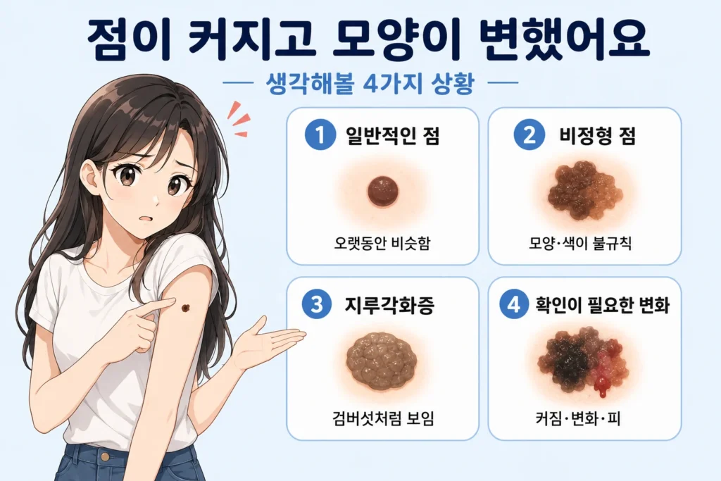 점이 커지고 모양이 변할 때 일반적인 점, 비정형 점, 지루각화증, 확인이 필요한 변화를 일본풍 애니 스타일 여성 대표캐릭터와 4개 카드로 보여주는 이미지